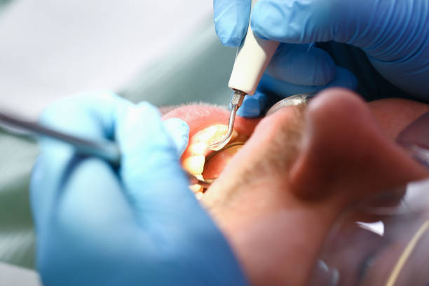 Best Emergency Broken Tooth Repair in Rutherfordton, NC