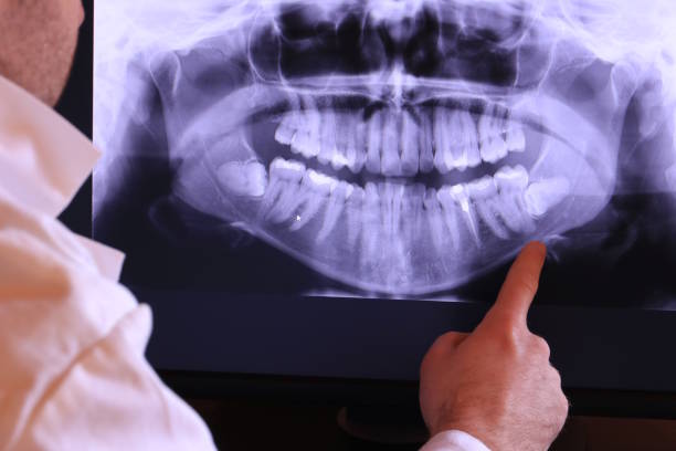Best Pediatric Emergency Dentist in Rutherfordton, NC