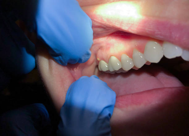 Best Weekend Emergency Dentist in Rutherfordton, NC